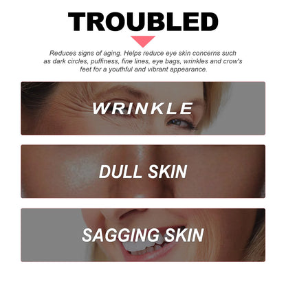 ✨ Retinol Eye Cream 👁️💖